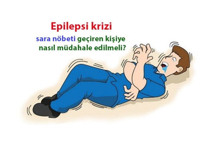 Sara (Epilepsi) krizinde ilkyardım nasıl olmalıdır? Sara (Epilepsi) krizinde ilkyardım nasıl olmalıdır?
