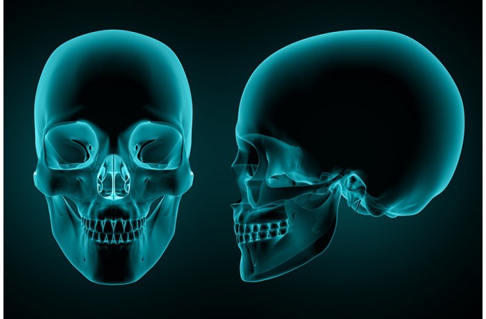 Kafatası Ve Omurga Yaralanmalarının Belirtileri Nelerdir? Kafatası Ve Omurga Yaralanmalarının Belirtileri Nelerdir?